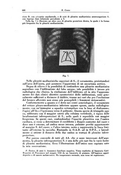 Rivista di patologia e clinica della tubercolosi organo ufficiale della Società italiana fascista di studi scientifici sulla tubercolosi