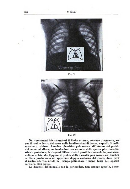 Rivista di patologia e clinica della tubercolosi organo ufficiale della Società italiana fascista di studi scientifici sulla tubercolosi