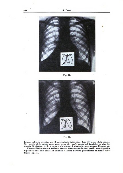 Rivista di patologia e clinica della tubercolosi organo ufficiale della Società italiana fascista di studi scientifici sulla tubercolosi