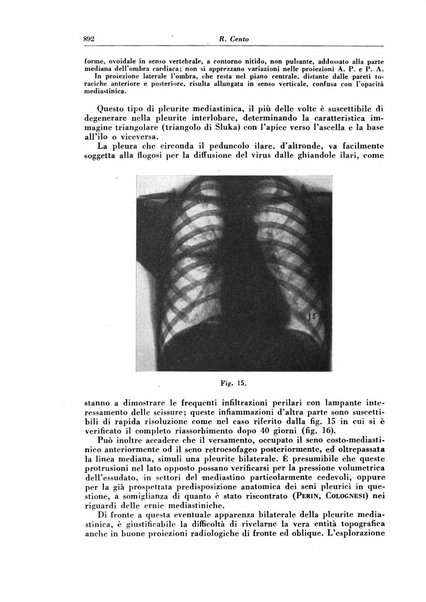 Rivista di patologia e clinica della tubercolosi organo ufficiale della Società italiana fascista di studi scientifici sulla tubercolosi