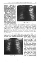 giornale/PUV0112329/1940/unico/00000049