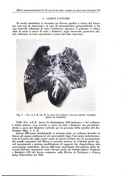 Rivista di patologia e clinica della tubercolosi organo ufficiale della Società italiana fascista di studi scientifici sulla tubercolosi