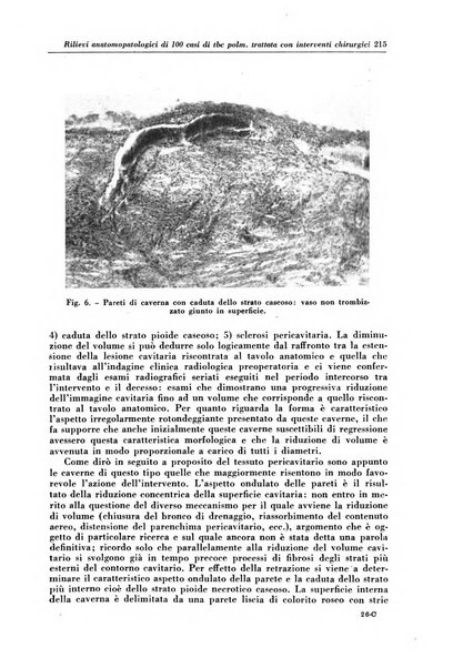 Rivista di patologia e clinica della tubercolosi organo ufficiale della Società italiana fascista di studi scientifici sulla tubercolosi