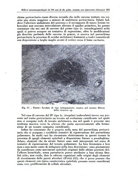 Rivista di patologia e clinica della tubercolosi organo ufficiale della Società italiana fascista di studi scientifici sulla tubercolosi