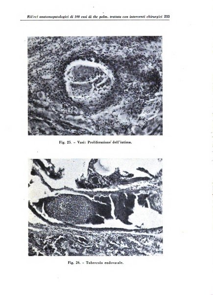 Rivista di patologia e clinica della tubercolosi organo ufficiale della Società italiana fascista di studi scientifici sulla tubercolosi