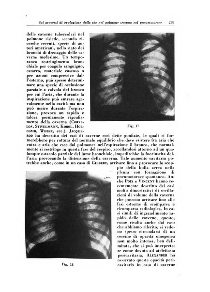 Rivista di patologia e clinica della tubercolosi organo ufficiale della Società italiana fascista di studi scientifici sulla tubercolosi