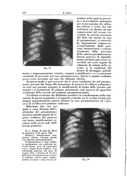 Rivista di patologia e clinica della tubercolosi organo ufficiale della Società italiana fascista di studi scientifici sulla tubercolosi