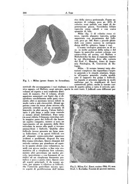 Rivista di patologia e clinica della tubercolosi organo ufficiale della Società italiana fascista di studi scientifici sulla tubercolosi