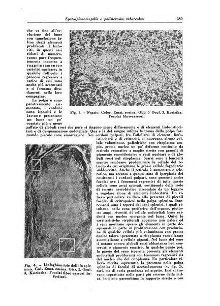 Rivista di patologia e clinica della tubercolosi organo ufficiale della Società italiana fascista di studi scientifici sulla tubercolosi