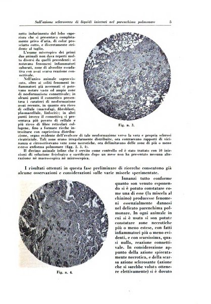 Rivista di patologia e clinica della tubercolosi organo ufficiale della Società italiana fascista di studi scientifici sulla tubercolosi