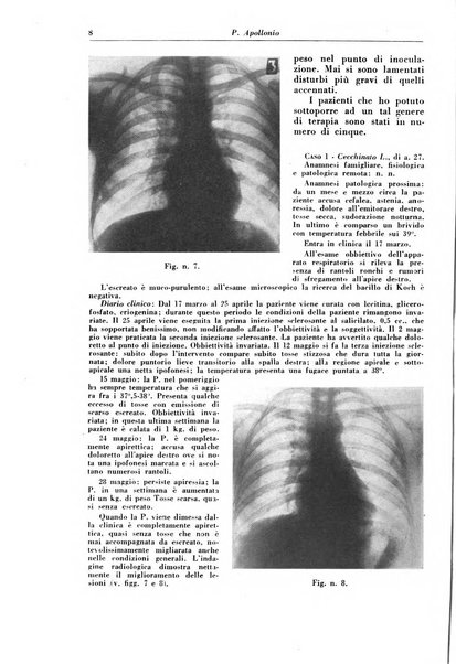 Rivista di patologia e clinica della tubercolosi organo ufficiale della Società italiana fascista di studi scientifici sulla tubercolosi