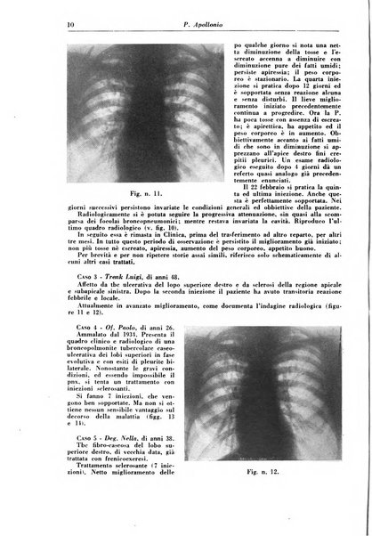 Rivista di patologia e clinica della tubercolosi organo ufficiale della Società italiana fascista di studi scientifici sulla tubercolosi