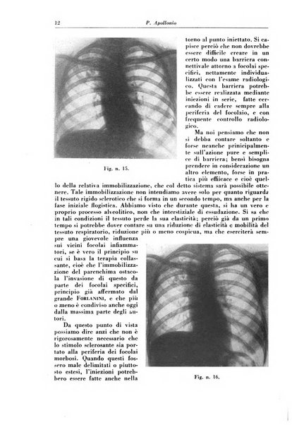 Rivista di patologia e clinica della tubercolosi organo ufficiale della Società italiana fascista di studi scientifici sulla tubercolosi