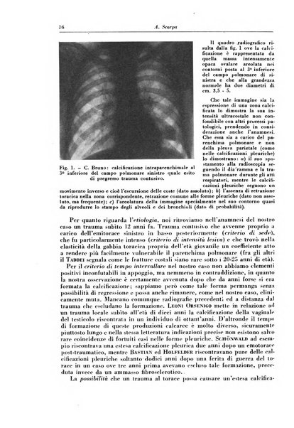 Rivista di patologia e clinica della tubercolosi organo ufficiale della Società italiana fascista di studi scientifici sulla tubercolosi