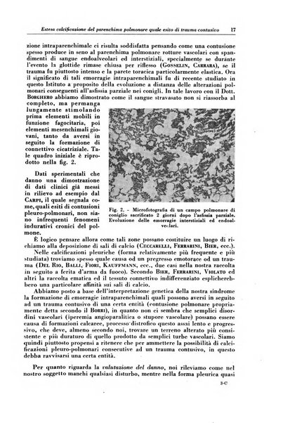 Rivista di patologia e clinica della tubercolosi organo ufficiale della Società italiana fascista di studi scientifici sulla tubercolosi