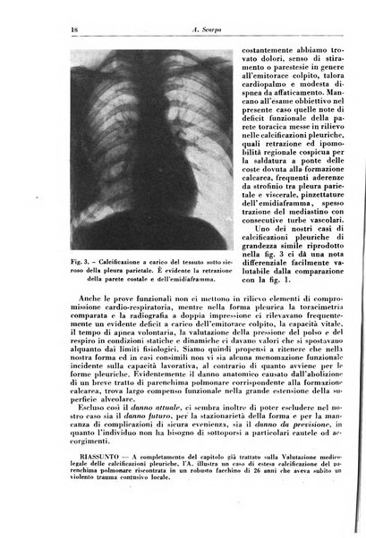 Rivista di patologia e clinica della tubercolosi organo ufficiale della Società italiana fascista di studi scientifici sulla tubercolosi