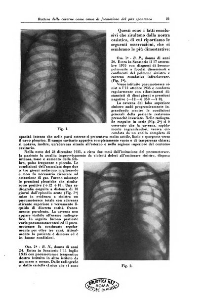 Rivista di patologia e clinica della tubercolosi organo ufficiale della Società italiana fascista di studi scientifici sulla tubercolosi