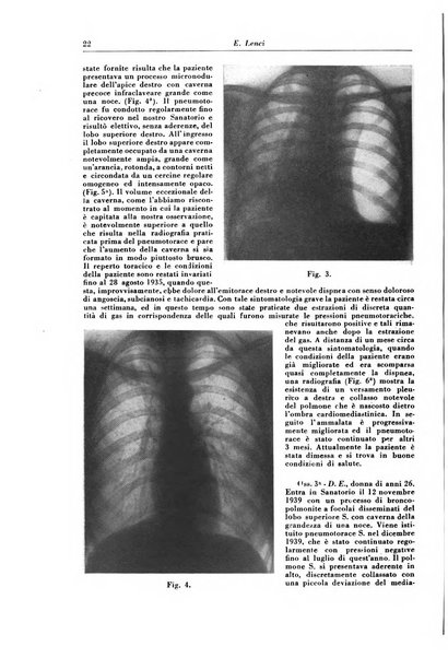 Rivista di patologia e clinica della tubercolosi organo ufficiale della Società italiana fascista di studi scientifici sulla tubercolosi