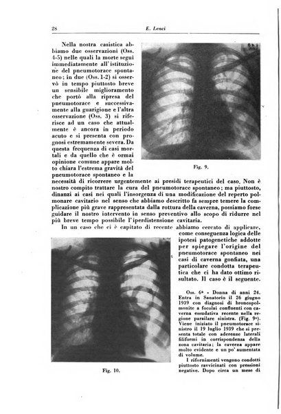 Rivista di patologia e clinica della tubercolosi organo ufficiale della Società italiana fascista di studi scientifici sulla tubercolosi