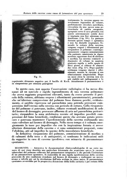 Rivista di patologia e clinica della tubercolosi organo ufficiale della Società italiana fascista di studi scientifici sulla tubercolosi