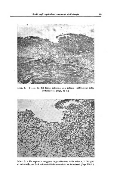 Rivista di patologia e clinica della tubercolosi organo ufficiale della Società italiana fascista di studi scientifici sulla tubercolosi