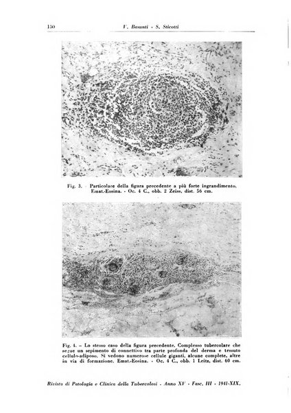 Rivista di patologia e clinica della tubercolosi organo ufficiale della Società italiana fascista di studi scientifici sulla tubercolosi