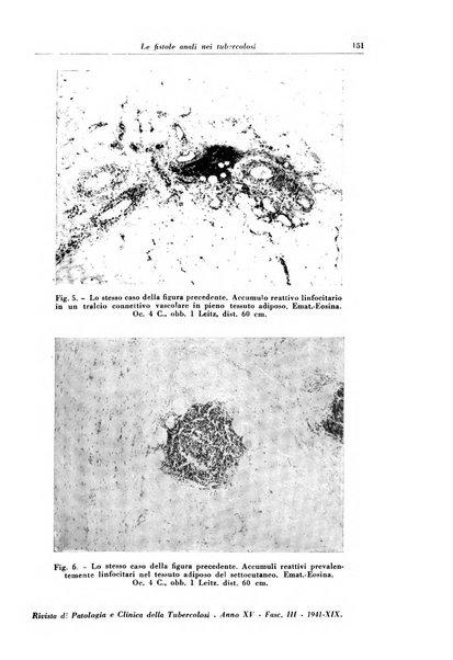 Rivista di patologia e clinica della tubercolosi organo ufficiale della Società italiana fascista di studi scientifici sulla tubercolosi