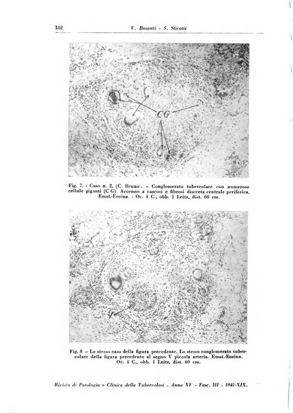 Rivista di patologia e clinica della tubercolosi organo ufficiale della Società italiana fascista di studi scientifici sulla tubercolosi