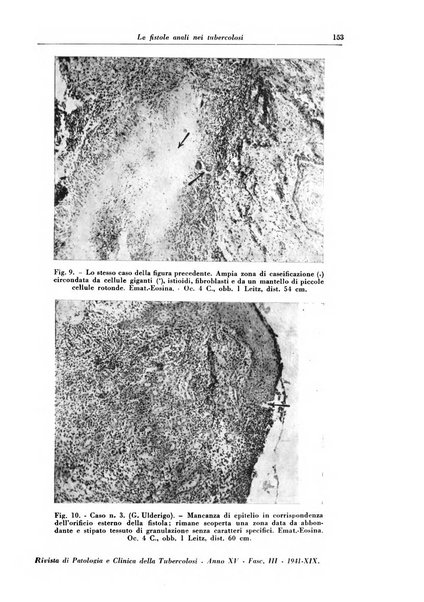 Rivista di patologia e clinica della tubercolosi organo ufficiale della Società italiana fascista di studi scientifici sulla tubercolosi