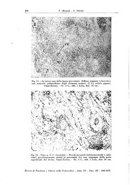 Rivista di patologia e clinica della tubercolosi organo ufficiale della Società italiana fascista di studi scientifici sulla tubercolosi