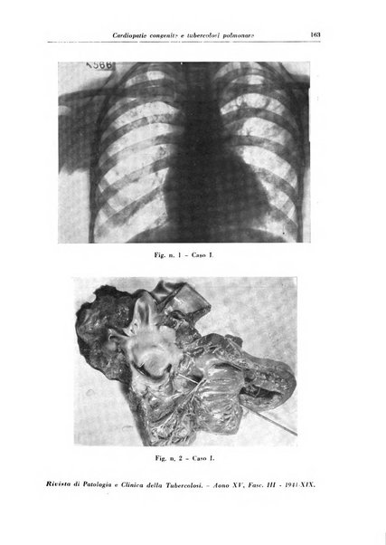 Rivista di patologia e clinica della tubercolosi organo ufficiale della Società italiana fascista di studi scientifici sulla tubercolosi