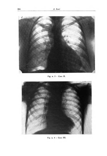 Rivista di patologia e clinica della tubercolosi organo ufficiale della Società italiana fascista di studi scientifici sulla tubercolosi