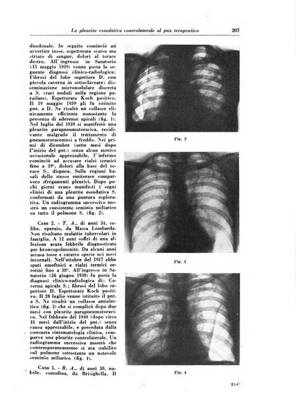 Rivista di patologia e clinica della tubercolosi organo ufficiale della Società italiana fascista di studi scientifici sulla tubercolosi