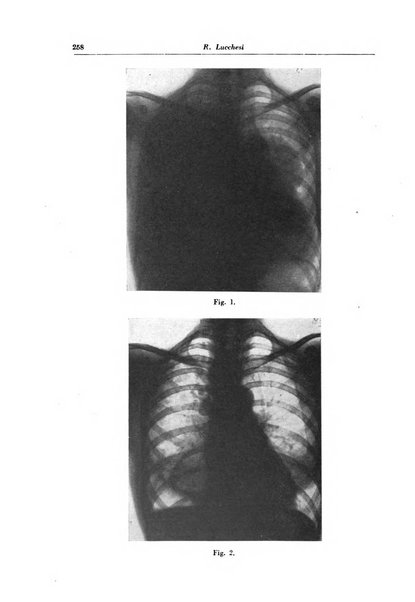 Rivista di patologia e clinica della tubercolosi organo ufficiale della Società italiana fascista di studi scientifici sulla tubercolosi