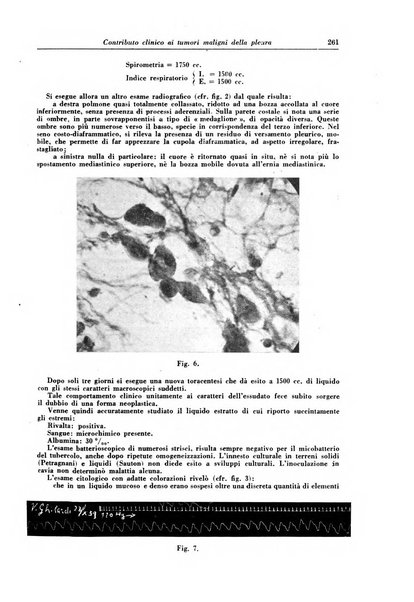 Rivista di patologia e clinica della tubercolosi organo ufficiale della Società italiana fascista di studi scientifici sulla tubercolosi