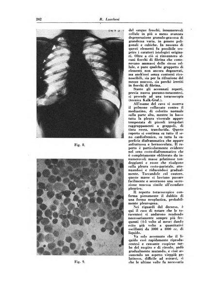 Rivista di patologia e clinica della tubercolosi organo ufficiale della Società italiana fascista di studi scientifici sulla tubercolosi