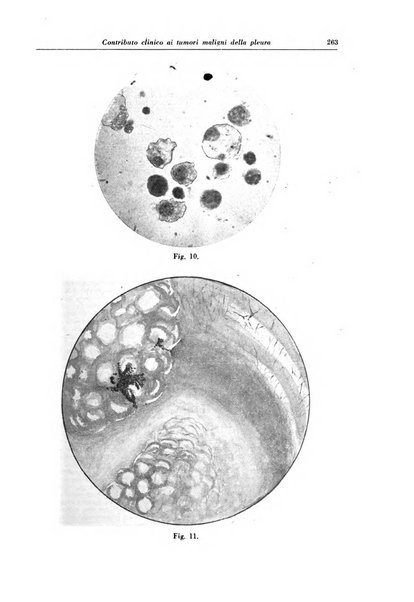 Rivista di patologia e clinica della tubercolosi organo ufficiale della Società italiana fascista di studi scientifici sulla tubercolosi