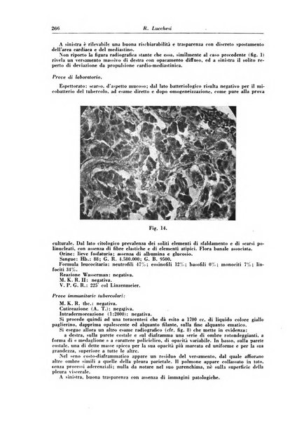 Rivista di patologia e clinica della tubercolosi organo ufficiale della Società italiana fascista di studi scientifici sulla tubercolosi