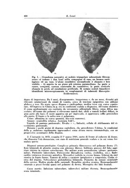 Rivista di patologia e clinica della tubercolosi organo ufficiale della Società italiana fascista di studi scientifici sulla tubercolosi