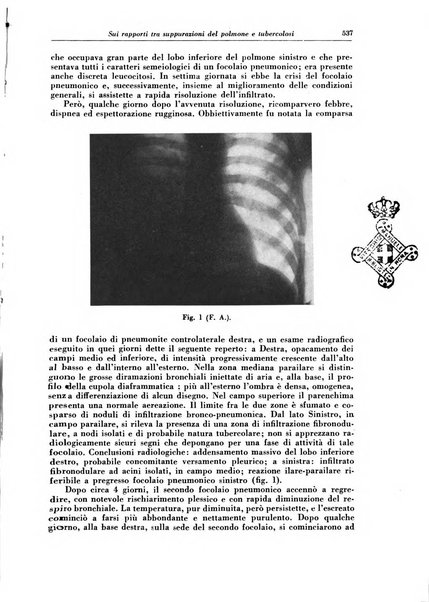 Rivista di patologia e clinica della tubercolosi organo ufficiale della Società italiana fascista di studi scientifici sulla tubercolosi