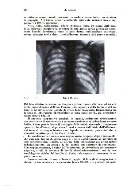 Rivista di patologia e clinica della tubercolosi organo ufficiale della Società italiana fascista di studi scientifici sulla tubercolosi