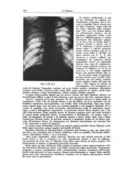 Rivista di patologia e clinica della tubercolosi organo ufficiale della Società italiana fascista di studi scientifici sulla tubercolosi