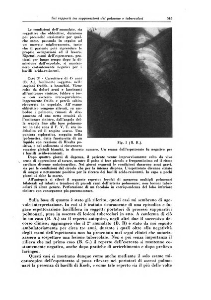 Rivista di patologia e clinica della tubercolosi organo ufficiale della Società italiana fascista di studi scientifici sulla tubercolosi