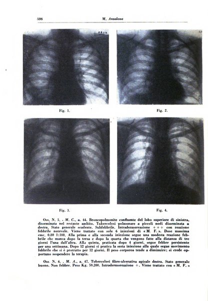 Rivista di patologia e clinica della tubercolosi organo ufficiale della Società italiana fascista di studi scientifici sulla tubercolosi