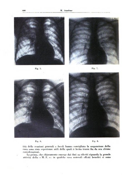 Rivista di patologia e clinica della tubercolosi organo ufficiale della Società italiana fascista di studi scientifici sulla tubercolosi