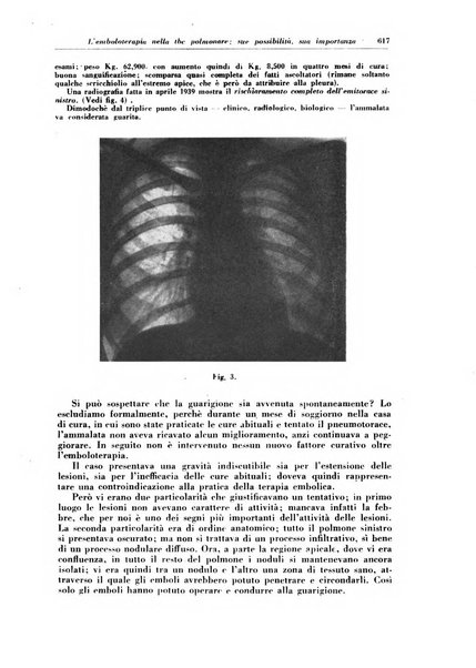 Rivista di patologia e clinica della tubercolosi organo ufficiale della Società italiana fascista di studi scientifici sulla tubercolosi