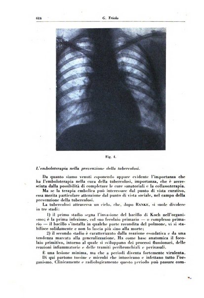 Rivista di patologia e clinica della tubercolosi organo ufficiale della Società italiana fascista di studi scientifici sulla tubercolosi