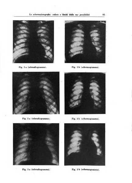 Rivista di patologia e clinica della tubercolosi organo ufficiale della Società italiana fascista di studi scientifici sulla tubercolosi