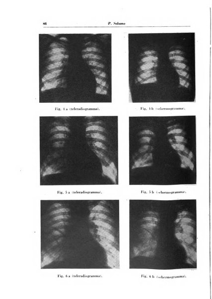 Rivista di patologia e clinica della tubercolosi organo ufficiale della Società italiana fascista di studi scientifici sulla tubercolosi