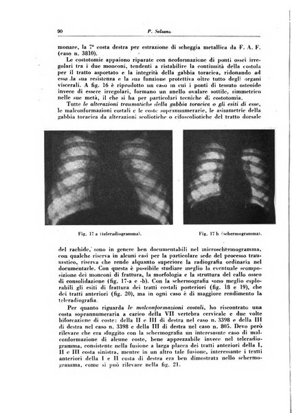 Rivista di patologia e clinica della tubercolosi organo ufficiale della Società italiana fascista di studi scientifici sulla tubercolosi